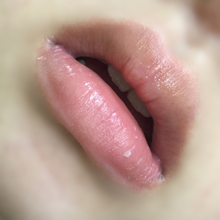 3. 물을 묻힌 면봉을 좌우로 슥슥 문지르면 없어보이던 각질이 나오게 됩니다 각질이 어느정도 나왔으면  물을 안 묻힌 면봉으로 각질들을 걸러줍니다