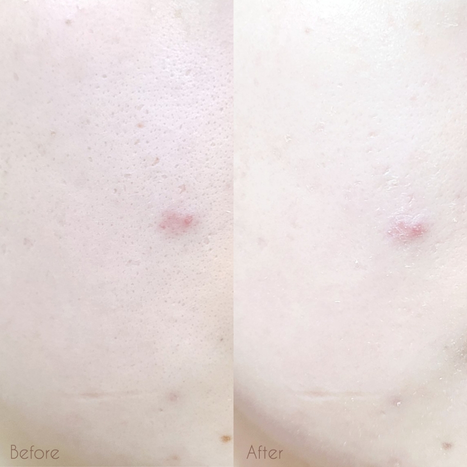 여러번 덧발라도 가볍고 편안한 물착톤업 생기충전템!

​

얇지만 피부 보정만큼은 강력한 AGE 20’s 비타 브라이트닝 톤업크림, 데일리 꾸안꾸 베이스로 추천드려요💕

