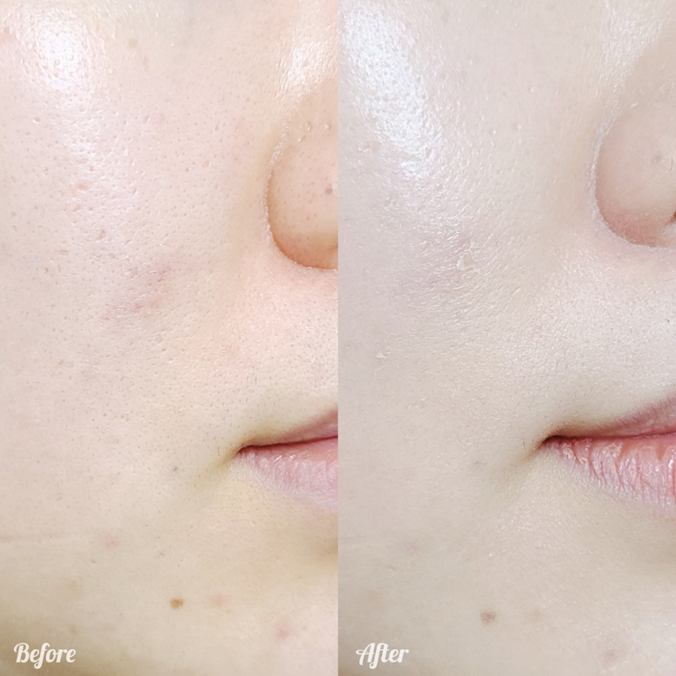 무겁거나 끈적이지 않으면서도 맑고 투명한 광채 피부 표현이 된다니 너무 좋은 것👍

​

기존의 오일리하고 무거우면서 피부 표현은 텁텁한 비비크림과는 전혀 달라요

​

가볍고 편안한 사용감은 톤업크림과 비슷하면서 커버력 면에서는 더 우수한 제품!

