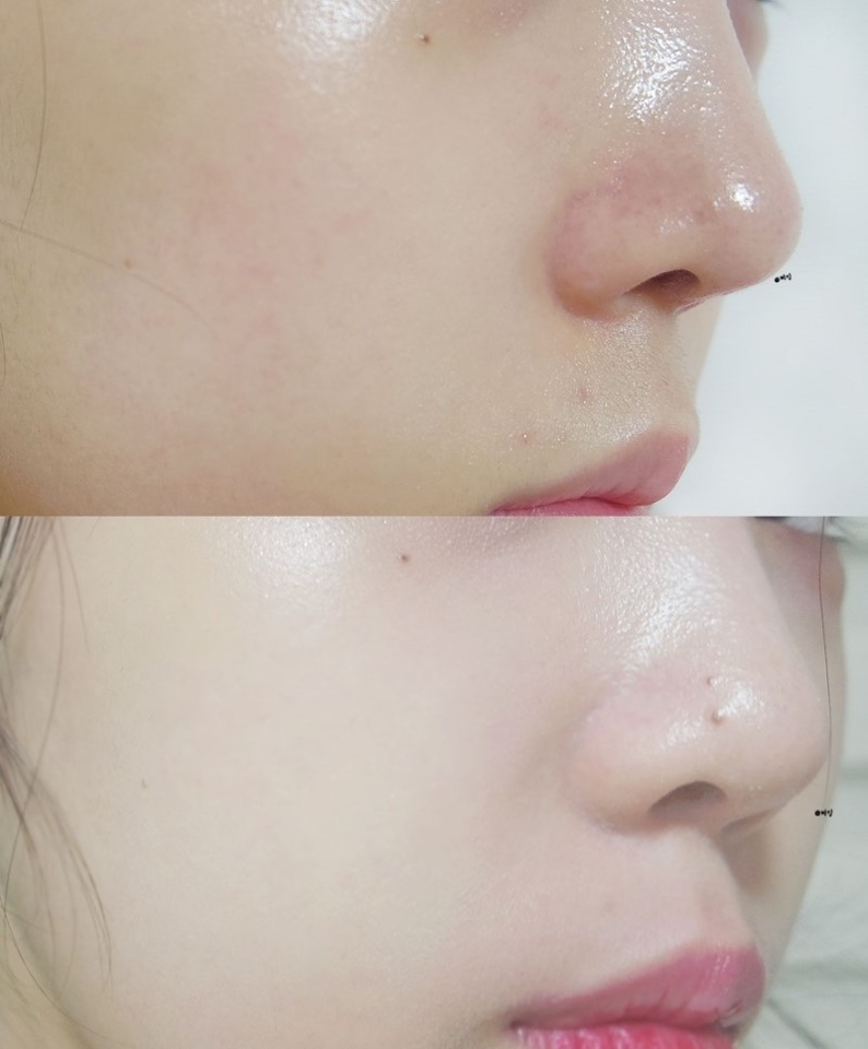 되직하고 무거울 줄 알았던
제 생각과 달리 제형이 아주 묽어요

짜고 옆으로 기울이면 흘러내릴 정도의
묽은 제형!

바를 땐 촉촉하고 부드럽게
발리는데 다 발리고 나면
바로 보송하게 마무리 되더라구요 ㅎㅎ

실키하고 가볍게 발리지만
커버력도 괜찮은 편 :)

손등에 테스트 해보니 울긋불긋 빨갛던 부분이나
실핏줄이 거의 커버가 되었어요~
