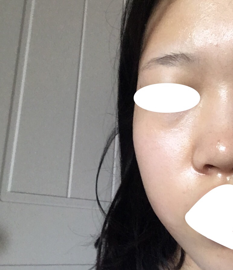 자고 일어난 직후의 모습입니다 확실히 바른 직후와는 차이가 나네요! 자는 동안 피부가 팩을 흡수해서 그런거같아요
이 사진은 자연광 밑에서 찍어서 다른 사진이랑 피부색이 달라보이는 거에여!