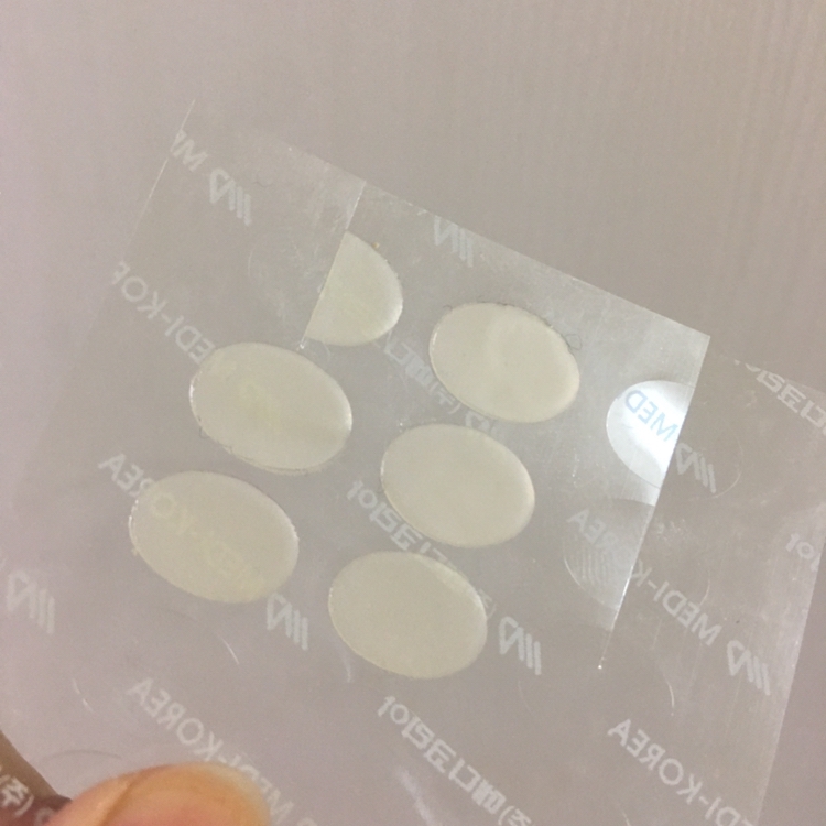 패치 뒤의 고정 판(?)이 빛을 자꾸 반사해서
사진 찍기가 어렵네요•••
이 트러블 패치 특유의 누런 색 뭔지 아시죠...?
피부에 가까운 색으로 만든 것 같은데
이상하게 들뜨는 색이라서ㅠㅠ차라리 투명했으면 해요