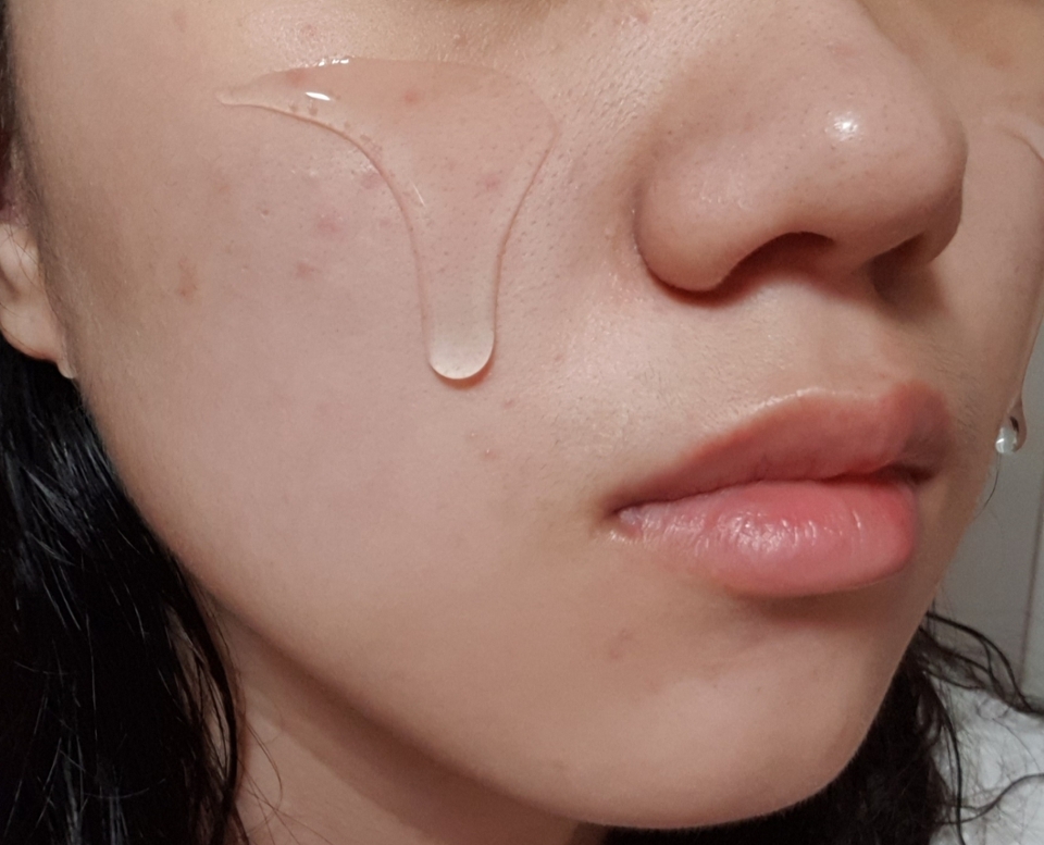 독도앰플을 발라보자