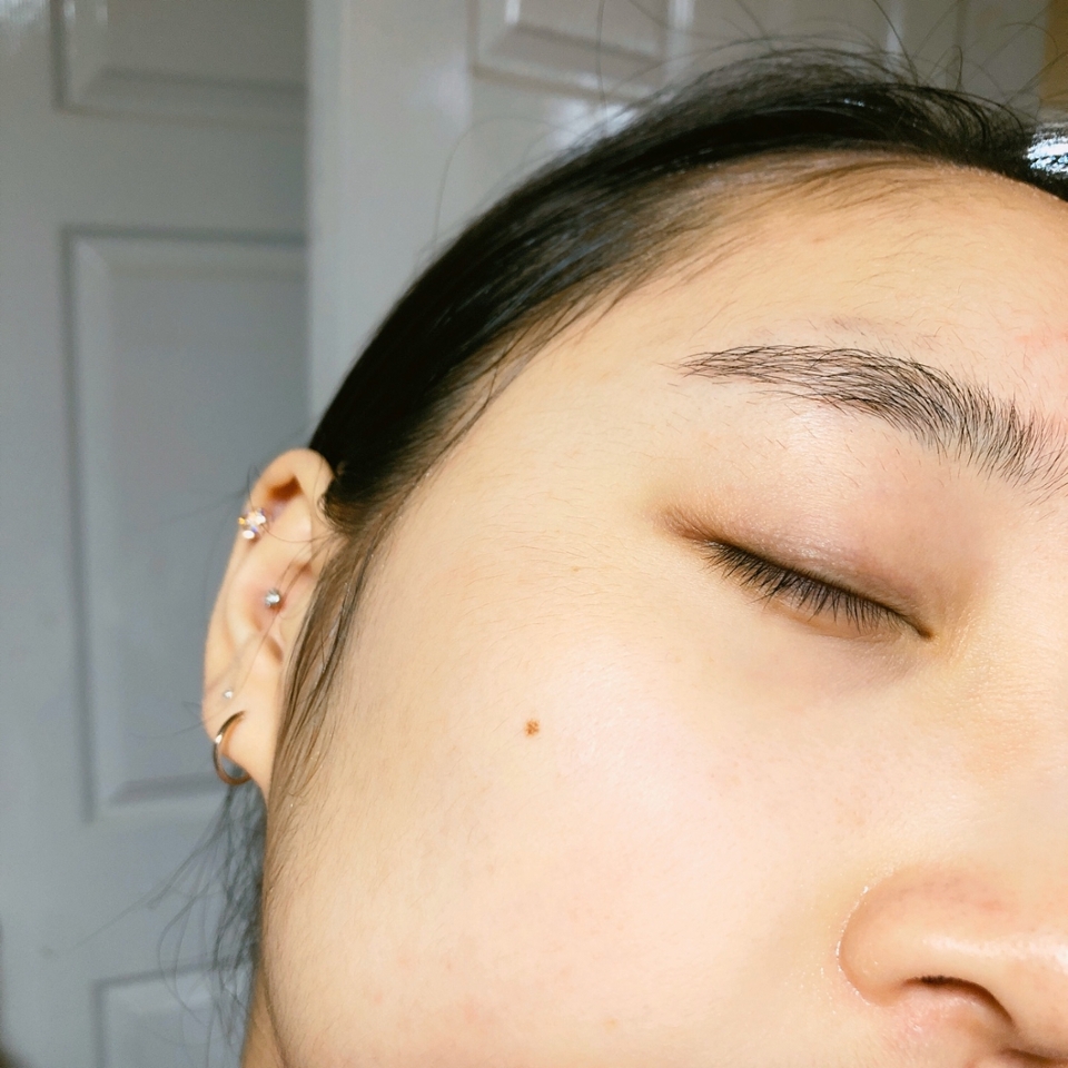 ▪️바르기 전
제 피부 타입에 대해 간략하게 말하자면 수분부족형(심한 속당김과 속건조) 복합성 + 민감성 + 여드름 피부 + 다크서클 + 홍조 이렇게 설명할 수 있어요! 집에서 씻을 때 정수필터를 사용해도 피부가 자극받을 정도로 예민한 피부랍니다