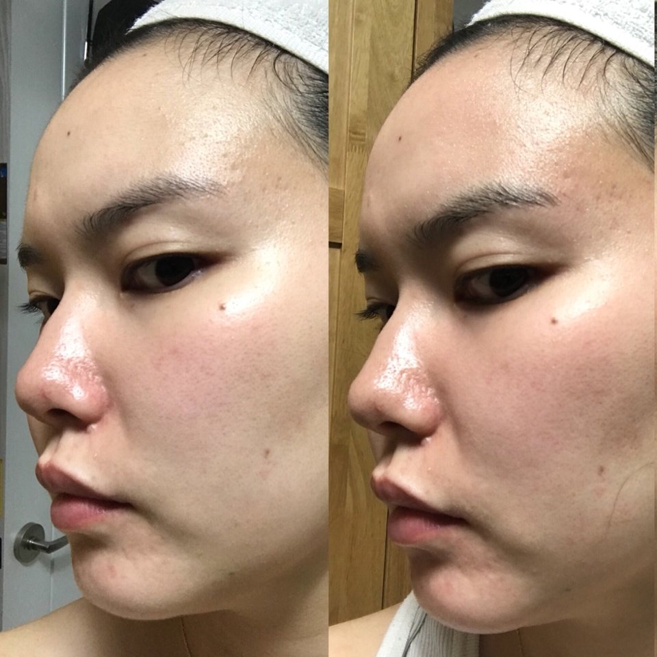 하지만 민감성인 저에겐 맞지 않았습니다.
따갑고 울글불긋해져서 사용 중지 했어요...
알찬 리뷰 들고 오지 못해서 죄송합니다 ㅠㅠ