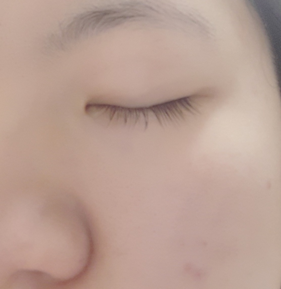 뾰루지와 누런 피부..