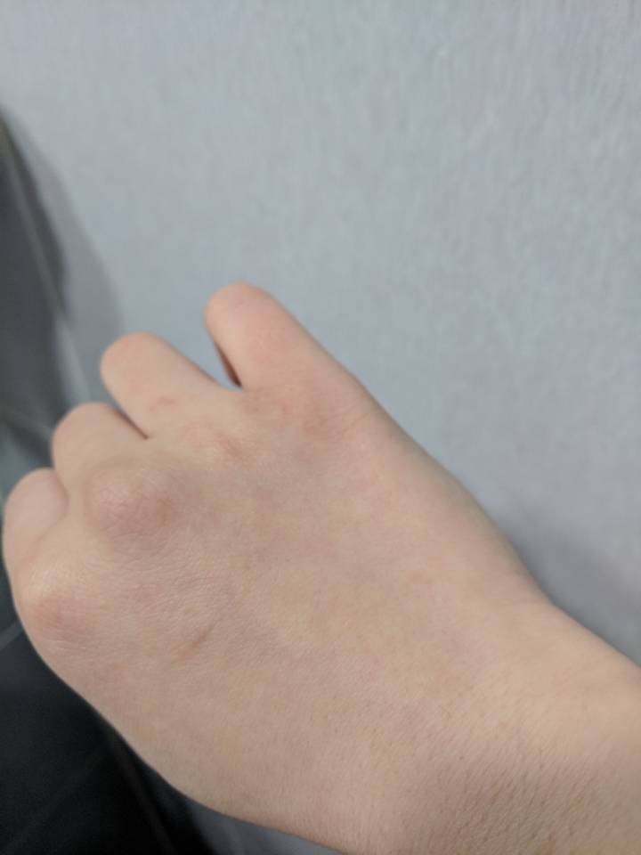 보이시나요!! 쵹쵹해진 제 손등!!!

피부톤이라던가 노폐물 제거는 단기간에 알 수 없고, 또 눈으로 봐서 정확히 알 수 없는거라 생각해서 (또 제가 둔한 것도 있구요!!)... 그 부분은 잘 모르겠지만 보습 효과는 짱짱! 다음 날 아침에 일어나고 또 손등을 한번 쓱- 봤는데  그 상태 그대로였답니다!! 보통은 다시 갈라져서 핸드크림을 치덕 치덕 발라줘야했었거든요 ㅜㅜ 흑흑

보습효과 짱짱 구달 비타민C토너패드!! 🍋🍋🍋이번 겨울 꾸준히 사용할 것 같네용