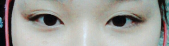 저는 무쌍인지 쌍카풀이있는건지 모르겟는 
눈이에요 저는 쌍카풀이 여러겹이 있습니다