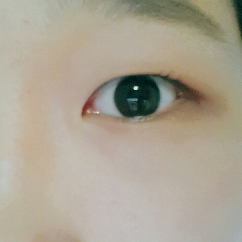 뷰러 한 쪽은 이렇게 눈이 조금이나마 트여보인다고해야하나? 그런것같아요