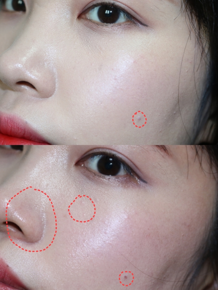 화장한 직후와 비교해보면 조명이 다르기때문에 어쩔수없이
피부톤차이가 많이 나는것처럼 보이지만
육안으로는 큰 차이는 없었고 다만 커버했던 잡티들이 조금 보여졌고
코주위 유분이 올라오면서 조금 무너진정도.
수정화장없이 11시간뒤에 이정도 컨디션이라면
그것도 촉촉함을 앞세운제품인데도 불구하고!!!!
매직쿠션 커버업제품은 어느정도의 커버력과 지속력을 가졌을지
기대하게되는거 같아요😆😆😆
여태 써본 쿠션중이 최강자는 헤라블쿠라고 자부했는데
매직쿠션,만만한 제품이 아닌듯하네요...
촉촉함과 밀착력,그리고 커버력과 지속력까지 다 갖춘 만능 매직쿠션,
💜진짜 강추합니다💜