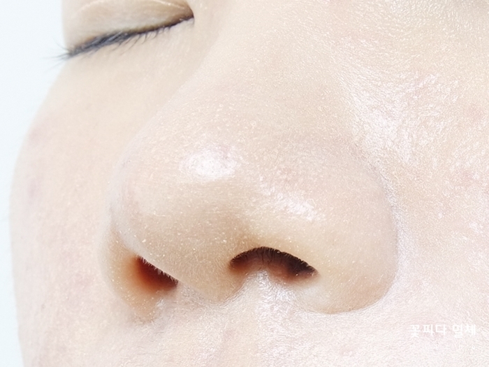 코부분 모공이 큰편인데 콧망울쪽에 뭉침이 보여서 아쉬웠던ㅠㅠ

지성피부라 T존쪽 모공이 다른곳보다 큰데,
이 부분은 아예 양을 적게 도포하든
도구를 이용해 얇게 펴발라주든 해야할거같아요