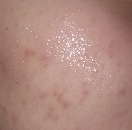 엄청 촉촉해보이지않나요?? 진짜 끈적이지 않고 넘 좋았어요! 에센스가 엄청 많아요! 약간 수분크림같은 느낌이랄까요?? 수분크림 가득 올려놓고 흡수시키는 느낌이였어요 ㅋㅋㅋ 흡수시키는데 5~6분 걸릴정도로 오래걸렸어요😆