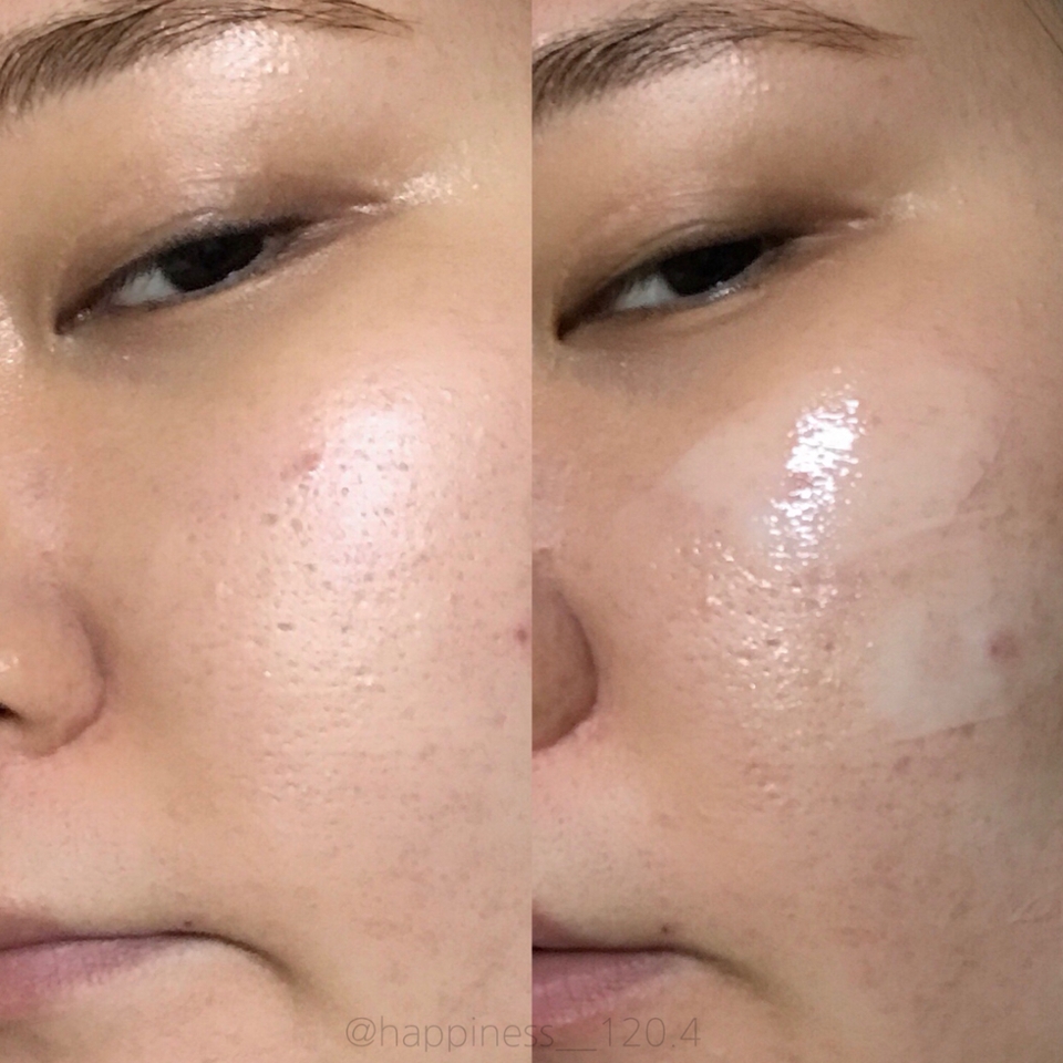 얇게 펴발라 줘야한다고 합니다 !!


총평📌
솔직히 써보고 놀랐어요 제가 민감성극지성피부인데도 살짝미세한 건조함이 있는데 속건조에 좋다는 에센스, 수분크림을 써도 안없어졌어요 👍🏻
근데 이 에센스를 쓰고난후 그 미세한 건조함을 잡아주었고 바르면 속부터 촉촉하게 해준다고해야하나, 피부 깊은 속부터 촉촉하고 마무리감은 끈적거리지않고 보송해요 유분감은 전혀없었고
튜브용기라서 위생적이고 간편해서 좋았어요
홍조, 트러블도 많이 진정이 되었고
눈 주위에 좁쌀여드름이 많이 올라오는데 완전히 없어지지않고 조금 덜나는정도로 효과를 봤어요
이 에센스를 바르고 나서 피부결이 매끈해지고 각질제거효과도 있는거 같아요
화장도 엄청잘먹고 무엇보다 파데나 톤업크림 발라주면 전혀 뜨지 않아서 진짜 좋았어요

다 쓰고 난후 재구매 20000% 정도예요 !! 👍🏻💙