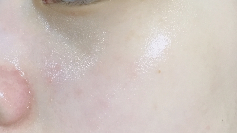 바른 후에요! 근데 사실 이게 보습력이 좋지는 않아요 여기서는 좋아보이지만 사실 이거 하나만 바르면 나중에 뭘 바른건가..? 싶더라구요 그래서 건성분들은 절대 이거하나만 바르지마세요.. 건복합성인 저희 엄마는 바르시자마자 건조하다고 싫어하시더라구요 그럼 읽어주셔서 감사합니다!