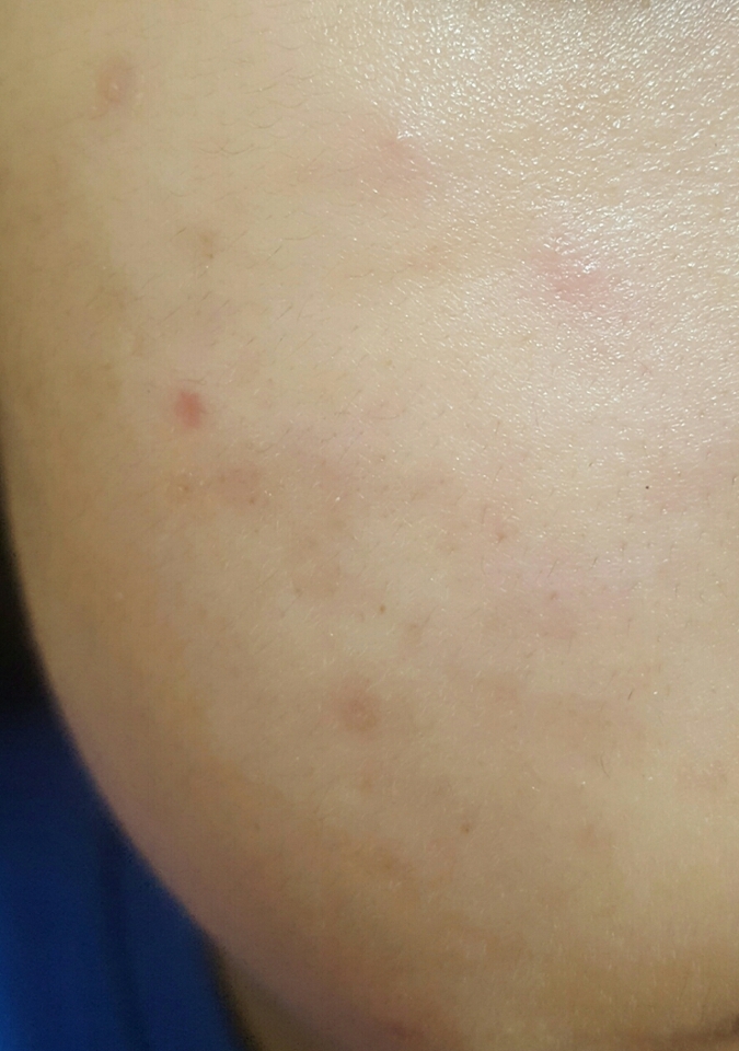 톡톡 두드려서 흡수시키니까 금방 흡수됩니당