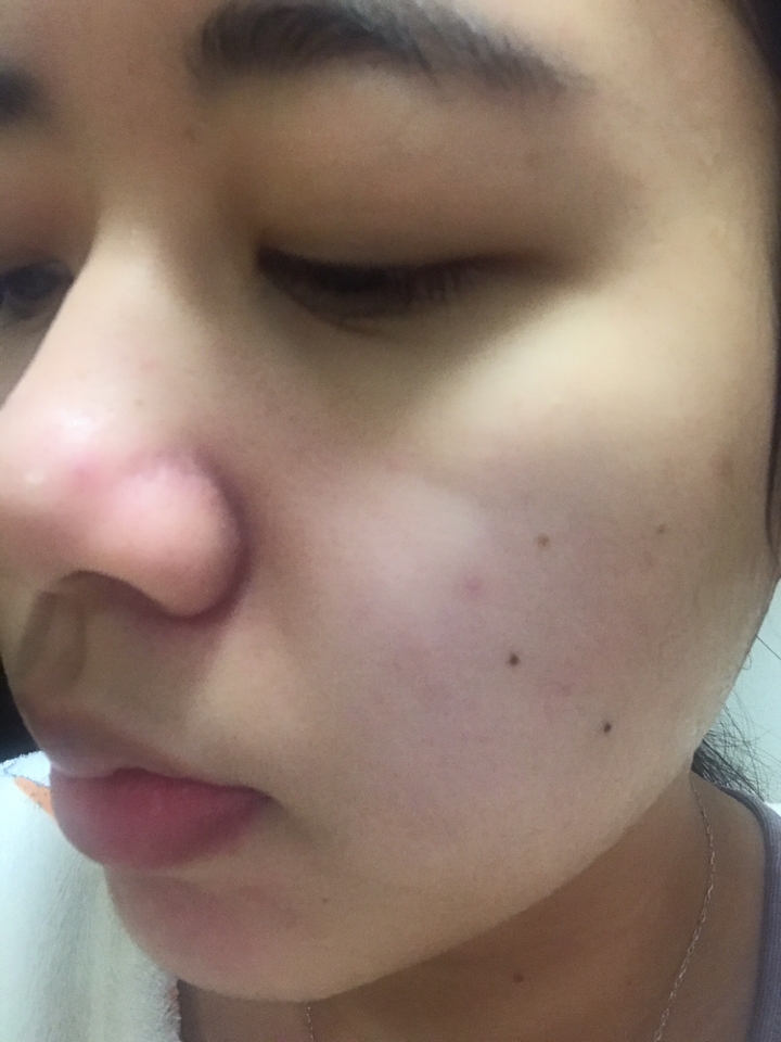 막 세수하고 나온 얼굴이에요..! ㅎ..
붉다 붉어.. 붉고 얼룩덜룩하다 증말 ㅋㅋㅋㅋ
갑자기 겨울이 된 이 날씨에 세수까지하면 진짜 건조해 미칠 지경이더라구요! 