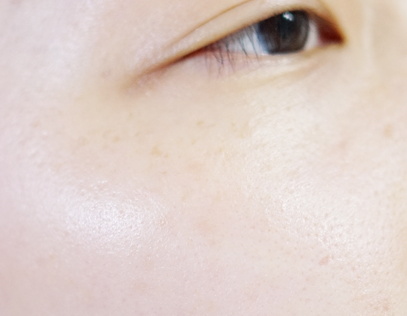 쌩얼이에요! 사실 요거는 세안하자마자 기초케어를 해준상태라서 엄청 건조하진 않은데요. 
이상태로 한 1분? 만 있어도..점점 피부가 당기고 각질이 일어나기 시작함 ㅠㅠ

그리고 파운데이션 마치고 돌아다니다 보면 점점 각질이 일어나서 속상합니다ㅠ