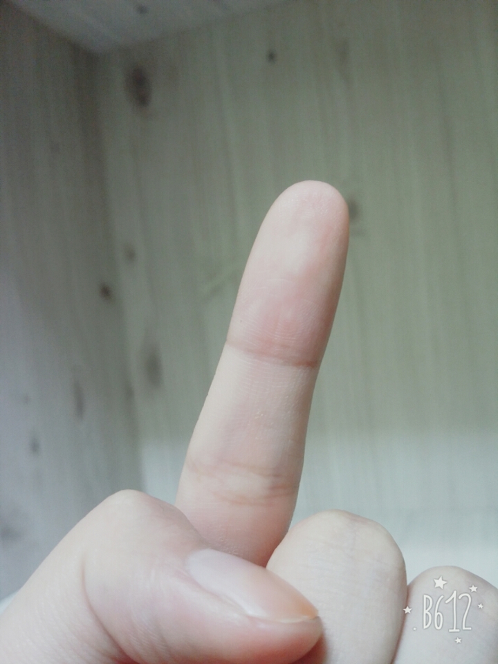 검지가 혈색이랑 가장비슷하답니다 :)