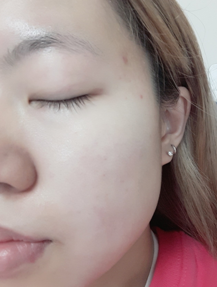 건조하다면 기초를 탄탄히 해주시고 가장 중요한 단계로 선크림을 꼭 발라주세요~!!! 안바르면 피부노화가 촉진되요... 저는 토니모리 톤업이 되는 선크림을 쓰고 있어요