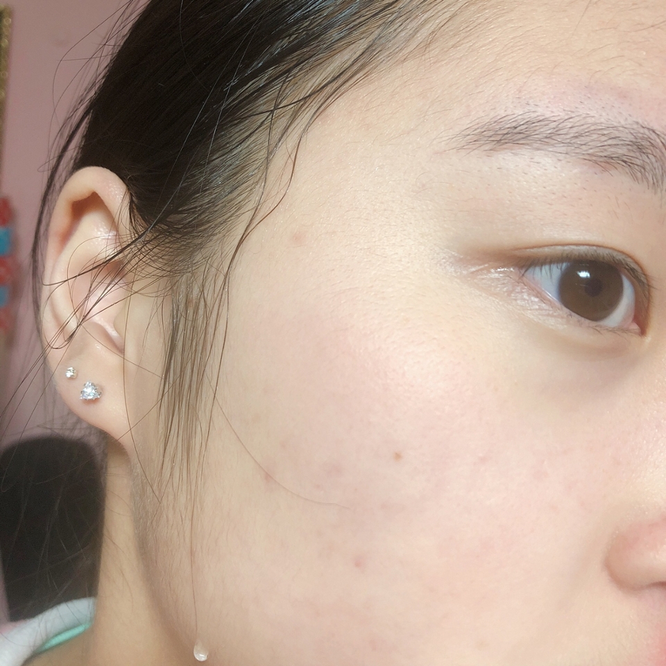 세안 후 독도 토너를 바르기 전!
제 피부 타입에 대해 간략하게 설명을 드리자면
수분부족형 복합성 + 민감성 인 피부에요!
속건조가 진짜 심한 편이고 씻고 나오기만 해도 온몸에 빨개지는 초예민한 피부를 가지고 있으며 트러블 피부입니다