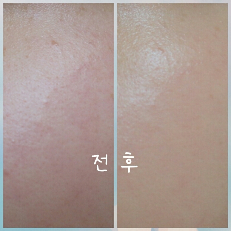 붉은기가 확실히 커버가 된것같아요~