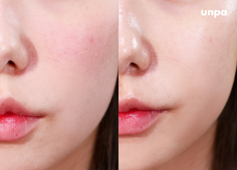 에디터 피부는 예민 + 건조함을 모두 갖고있는 그야말로 no answer..피부인데
이런 피부,, 환절기 되면 더 심해지는거 다들 알고있지?
요 자작나무 수분크림은 너무 무겁지 않으면서도
촉촉한 수분감을 피부 쏙쏙 채워주면서 피부 진정까지 잡아줘서
왜 1등크림인지 바르면서도 알 것 같더라