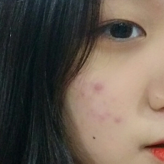 아무리 화장해도 가려지지 않는 이런 드름이들...ㅜ