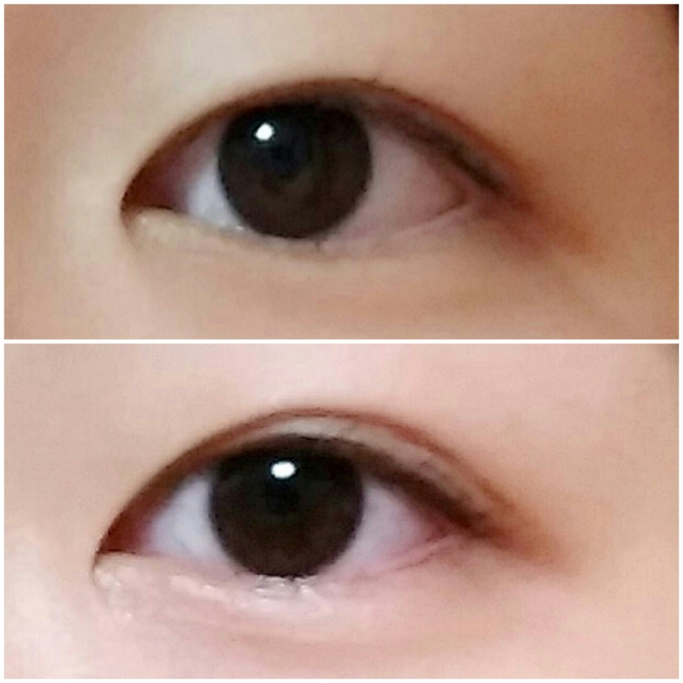 여튼 싸고 가격대비 무난하게 쓸수있는 다이소 쌍테 전후사진입니다!