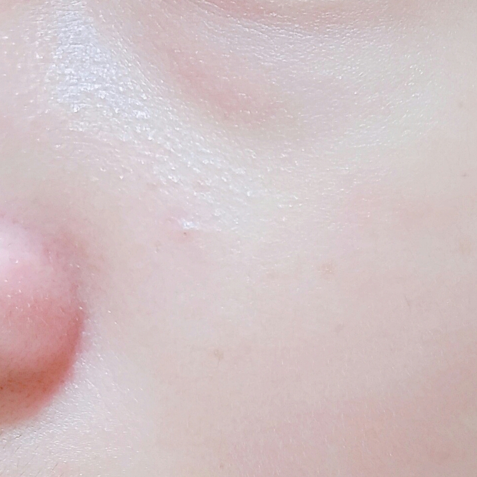세안 후 피부 상태에요!

코 옆 각질은 그대로지만 
티존에 있던 기름기도 어느정도 없어지구
볼이나 입 주변도 좀 촉촉해진 느낌이 들어요!

하지만 뽀득뽀득한 느낌이 없어서
뭔가 제대로 씻기지 않은 듯한 부족함이 드네요ㅠ.ㅠ
촉촉하긴 하지만 기름기같은 건 완전히 안 없어져서
사알짝 아쉬운 느낌이 들었어요..!😂

그래두 부드럽게 촉촉하게 잘 씻겨지구
피부가 민감한데 붉어지거나 트러블도 안 나서
좋은 것 같아요!!👍👍

지금 케어존 약산성 폼 클렌저 200ml + 케어존 딥클린 젠틀 필링젤 50 ml 
2개 합해서 정가 15000원짜리 12000원에 판매중이라
피부가 건조하신 분들이나 민감하신 분들은 한번 구매해보셔도 좋을 것 같아요!!
추천추천!!👍👍