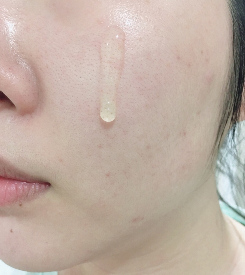세안 후 토너로 피부결을 정돈해 주고 잡티세럼을 1회 펌핑했어요

투명하고 젤 세럼 같은 제형이라서 얼굴에 자극없이 부드럽게 잘 발려요

청귤 세럼이라 상큼한 향이 강할줄 알았는데 의외로 향이 은은해서 잘 느껴지지 않았어요!

보통 비타민c 제품은 첫 사용때 피부가 따가운 제품들이 있어서 사용하면서 따가움이 점점 줄어들게끔 적응기간이 필요했는데 이 제품은 첫 사용때부터 피부 따가움이 느껴지지 않았어요