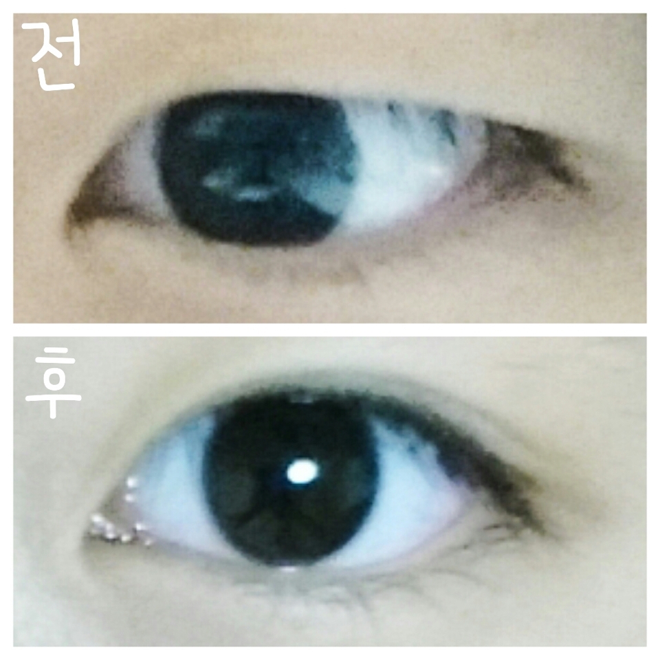 전/후 차이