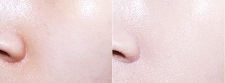 발라본 모습은 이정도!
소개된글들을 보면 피지컨트롤등의 설명이 쓰여있는데 제가 느끼기에는 상당히 촉촉한 편이었구요
좋았던 점은 촉촉한 대비 굉장히 가볍고 밀착력이 좋아서
다른 촉촉한 쿠션들에 비해서 묻어남이 상당히 적은 편이었어요!
커버력도 좋습니다!