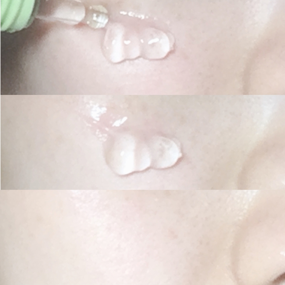 제가 원래 수분 젤 제형의 스킨케어 제품을 여름말곤 잘 안 쓰거든요? 솔직히 여름에도 그닥 쓰는걸 좋아하진 않는데, 이건 진짜 좋아요!!
제형은 수딩젤 같은데,,, 끈적임도 없고 바르고 나서도 피부에 촉촉하고 매끈한 마무리감을 선사하고, 안 건조해요!! 가끔 이런 제형들은 쓰고 나서 바로 흡수되거나 수분이 말라서 되려 피부가 건조하고 그러는데, 이건 그런 느낌이 없어서 진짜 좋더라구요 ㅠㅠ 시카 세럼이라 성분도 순해서 자극도 하나도 없어서 완전 편안한 사용감이었어요...★
개인적으로 이 제품은 진짜 추천하고 싶어요!!