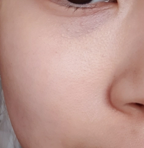 손으로 토닥토닥 흡수시켜줬어요🙂
도포 전보다 촉촉해보이고 붉은기도 좀 줄어들었어요😆😆