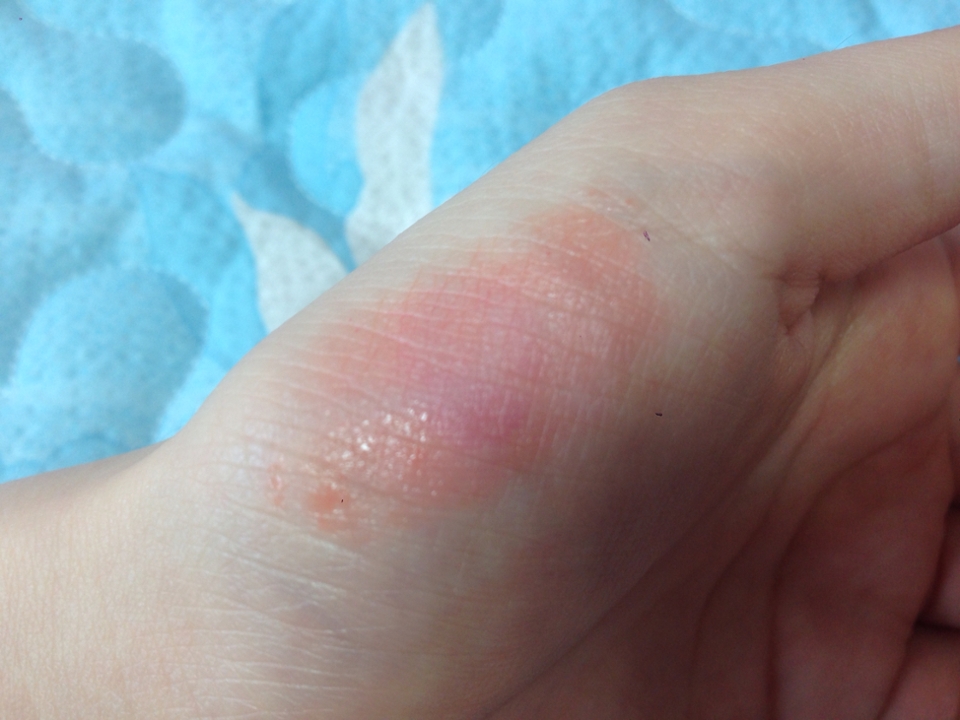 가면갈수록 핑크가 된답니닼ㅋㅋㅋ 착색은 분홍색으로 되는 편이예요 ㅠㅠ