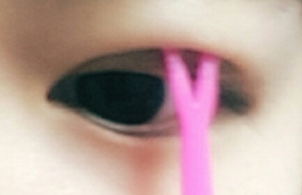 액이 투명해지면 Y스틱으로 살을 찝어주세요