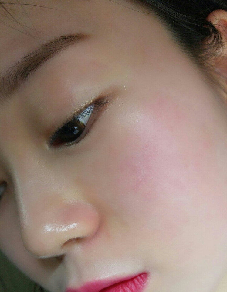 어느정도 베이스가 다 녹고 보습이 된다싶을때 깨끗한 티슈로 보습밤을 걷어내주세요!  부드럽게 해주셔야지 안그러면 피부가 마찰로인해 다시 벌겋게 달아올라요!