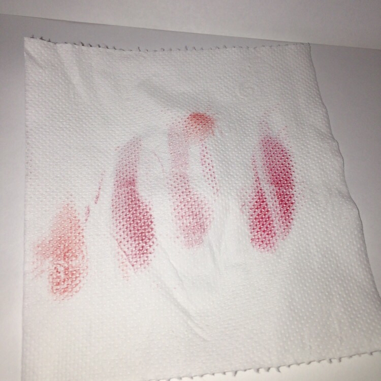 티슈로 한번 닦아내었는데요
립스틱인지라 뭍어남이 없진않지만