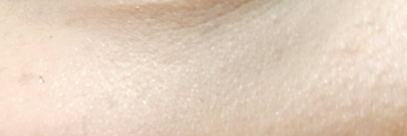 바른 직후 입니다
아주조금 환해졌지만 다크는 여전히 흐릿하게 남아있습니다