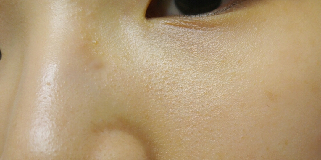 먼저 아무것도 바르지 않은 맨피부입니다.
블랙헤드ㅠㅠㅠ가 가장 눈에 보이고
모공이 넓은게 보이네요