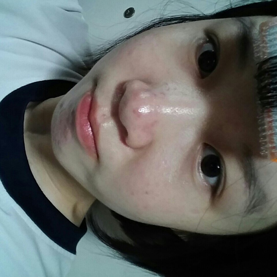 에크 사진이 뒤집어졌네용
다 발라주면 엄청나게 번들번들하고 찝찝해집니다😩
이런거 많이 갑갑해 하시는 분들은 쓰기 좀 불편하실듯 해요ㅠㅠ