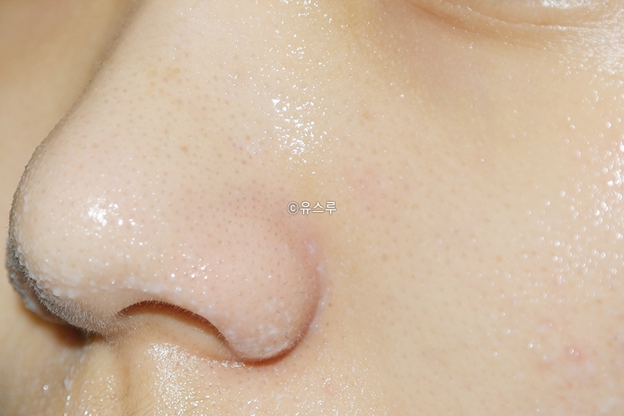 블랙헤드 마사지 후 물을 조금 덜어 하얗게 유화시켜주면 오일과 합쳐져 떨어져나온
피지찌꺼기들이 사르르 녹아들어요~

클렌징오일 잘못된 사용법으로 쓰시는 분들 많던데 유화를 해줘야만 노폐물이 얼굴에서 녹아내립니당, 