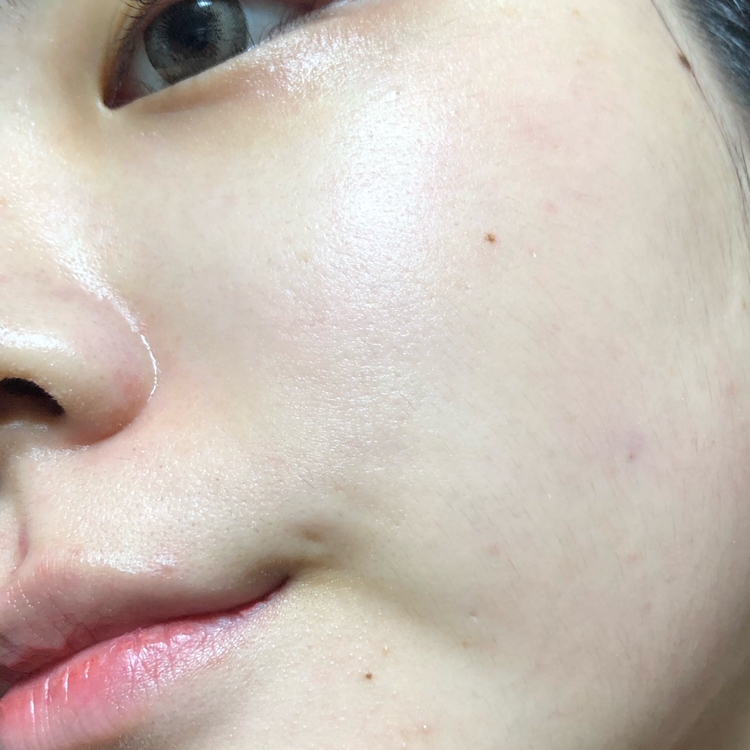 10분뒤에 마스크팩을 떼어줬어요.
엄청 많던 에센스가 다 피부에 스며들었어용