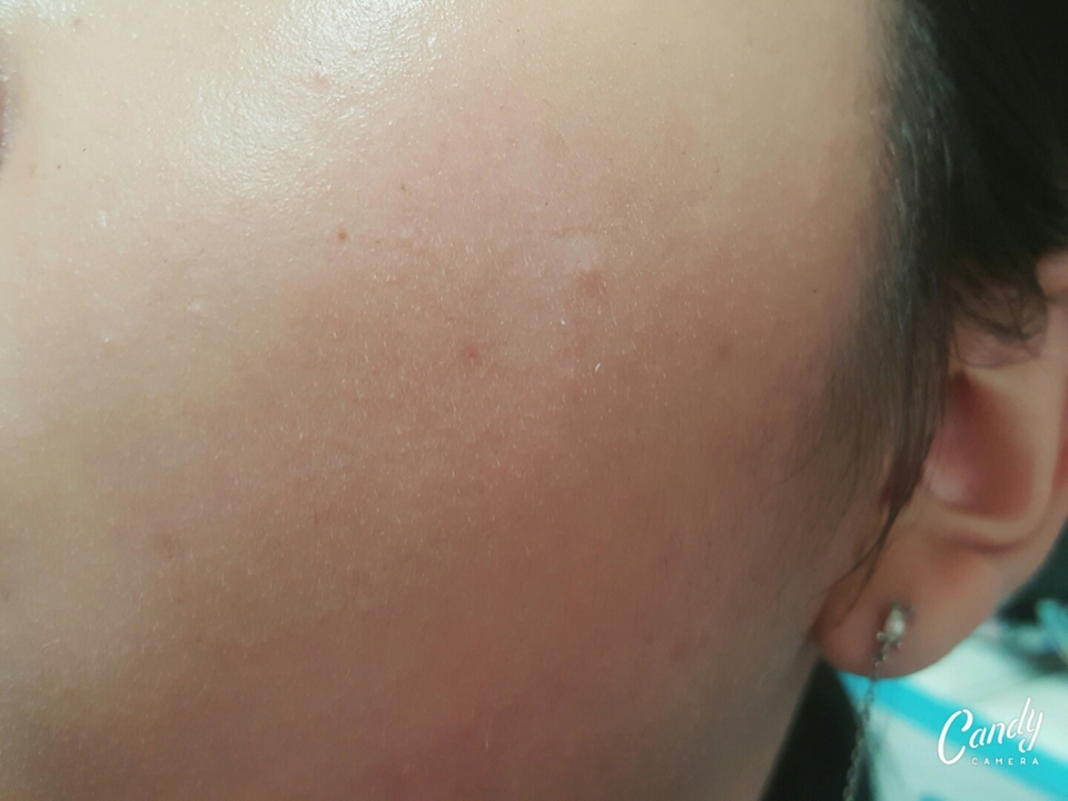 네...저의 볼따구를...핳