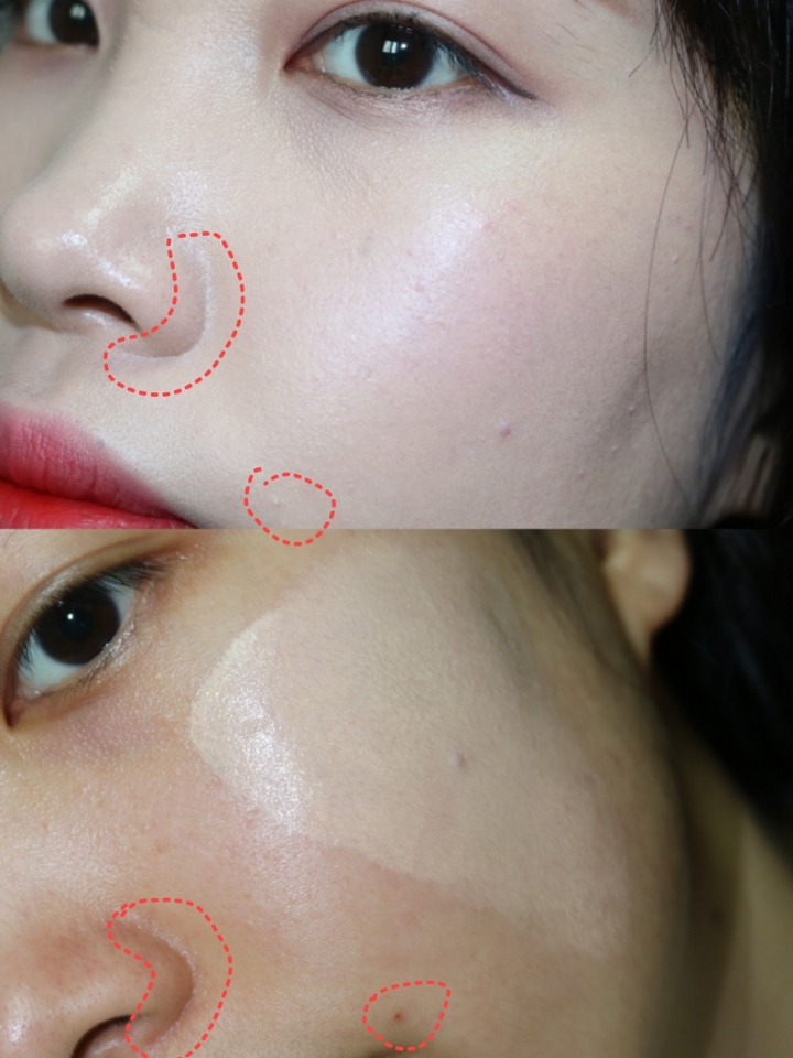위사진과 비교해보시면 입옆에있는 붉은 트러블자국
볼중앙에있는 트러블흉터,코주위의 붉은끼 까지...
커버력 대단하지않나요??