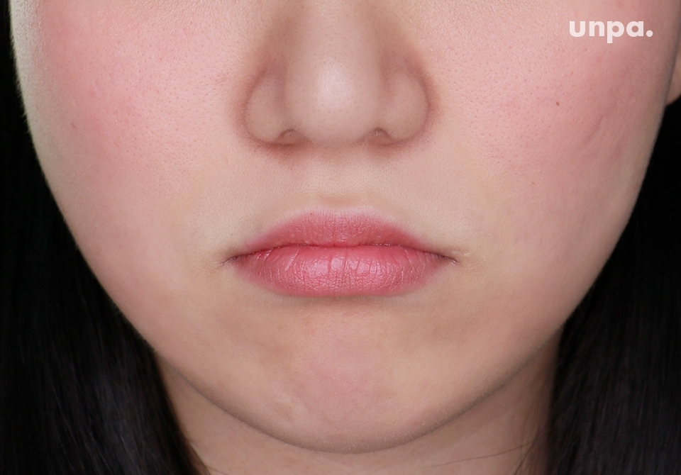 여름철 필수템, 자외선 차단제! 중요한 거 알지만
피부가 울긋불긋 초초초 민감 피부 에디터는
아무 선크림이나 함부로 못쓴다구요 ㅠ,ㅜ (우울)