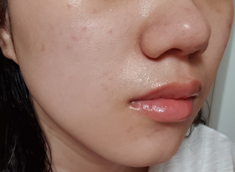 엄청나게 촉촉하죠?? 사실 이 독도앰플을 하나만 발라줘도 기초케어는 충분할 정도에요 순하고 수분감으로 짱이고 의미도 있으니 좋은 제품이에요~