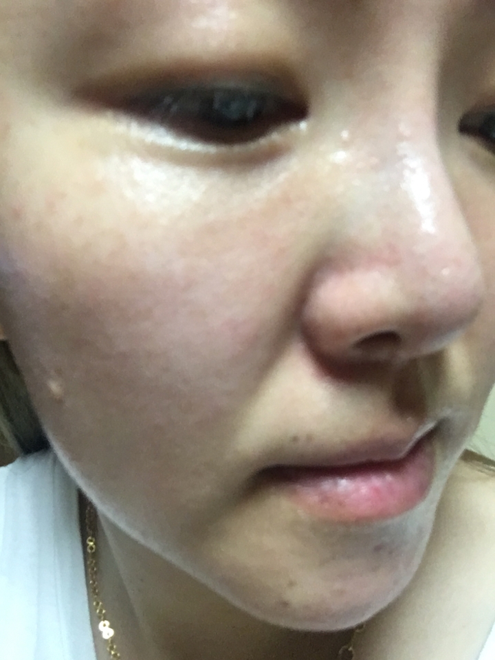 #효비담 바른후 모습이예여
