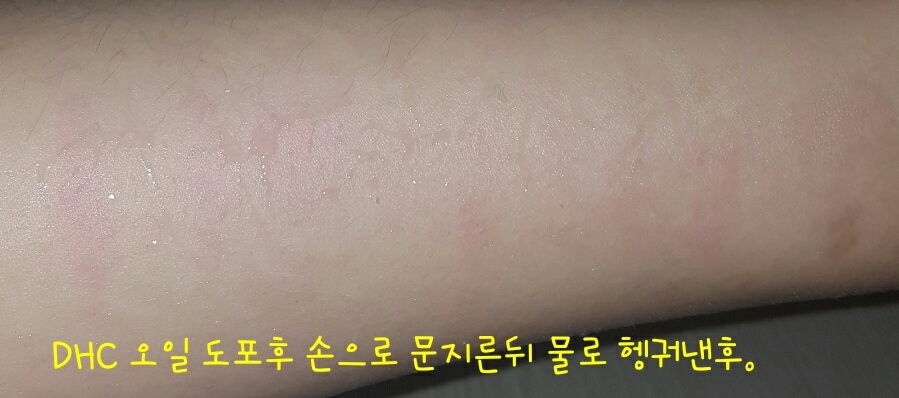 좀..많이 빨개유..왜 다 안지워지지? 라는말과.. 열심히 문질한결과입니다.. (얼굴엔 그러지마십시오)
보니깐 페리페라님과 입생님의 잔여가..좀 남아있으시네요
물로 헹궈내니깐 더 잘지워졌어요!!
보니깐 즉시세안 노노함..입니다♡..
유화과정진행하세용!