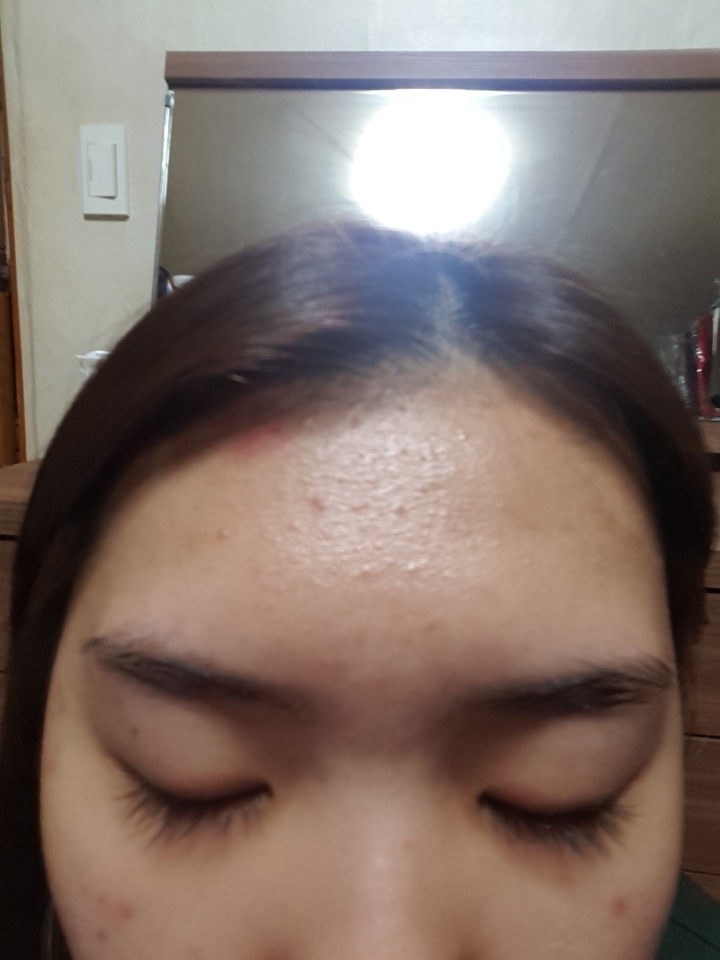 이마

광이 흐릅니다 ㅎㅎㅎ